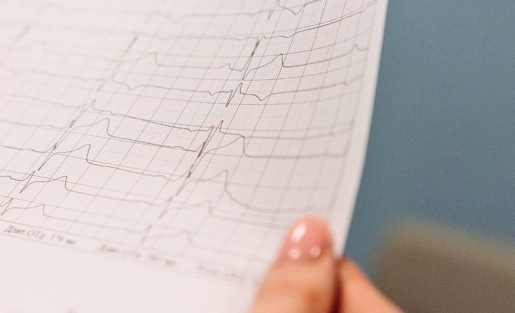 Electrocardiografía